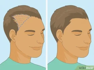 Read more about the article How to Stop Hair Loss and Regrow Hair Naturally: Effective Home Remedies